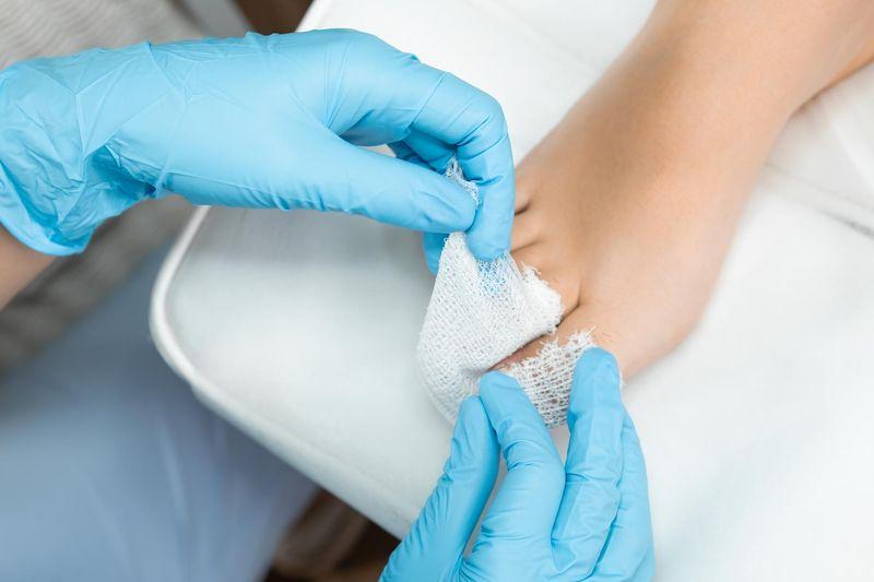 Грибок ногтей на ногах: чем лечить болезнь?